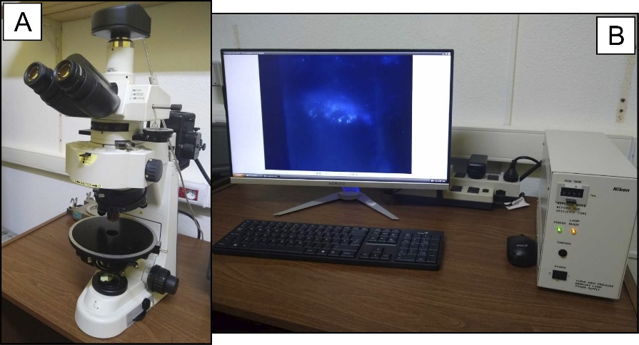 A: microscopio con una lámpara de mercurio. B: equipo de
			Fluorescencia con luz incidente UV.